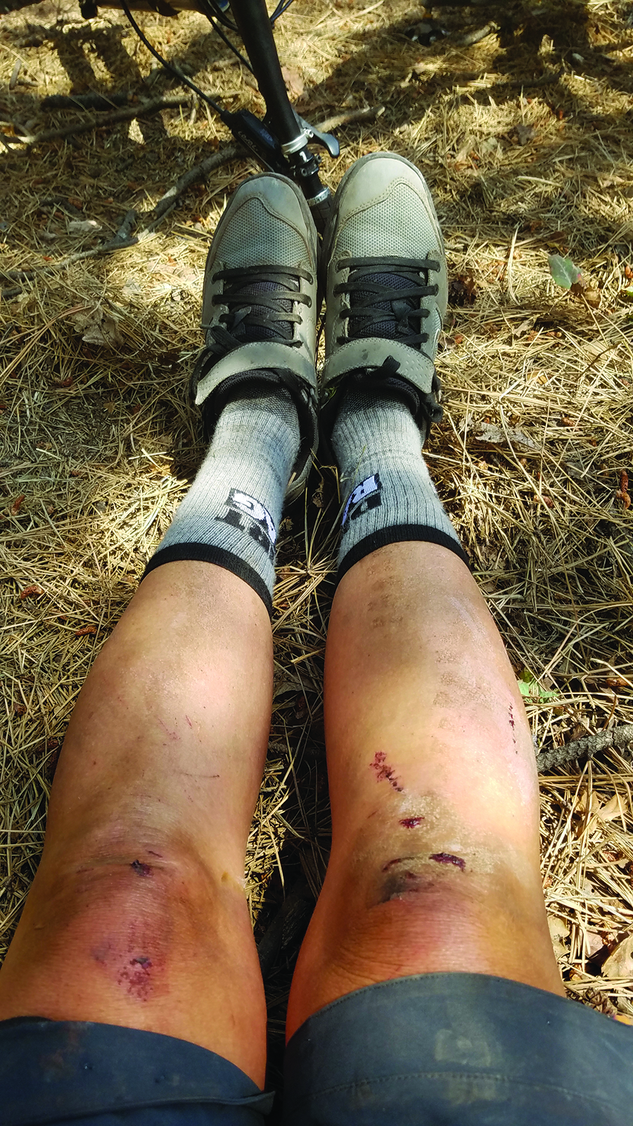 cycling for mental health